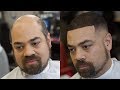 Man Weave Hair Loss Hair Unit from Chrome web store to be run with OffiDocs Chromium online Man Weave Hair Loss Hair Unit from Chrome web store to be run with OffiDocs Chromium online