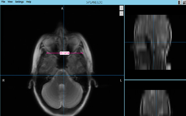 MRI Scalar from Chrome web store to be run with OffiDocs Chromium online MRI Scalar from Chrome web store to be run with OffiDocs Chromium online