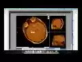 DICOM image viewer from Chrome web store to be run with OffiDocs Chromium online DICOM image viewer from Chrome web store to be run with OffiDocs Chromium online