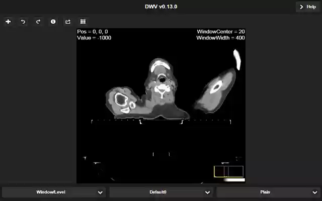 dwv from Chrome web store to be run with OffiDocs Chromium online dwv from Chrome web store to be run with OffiDocs Chromium online